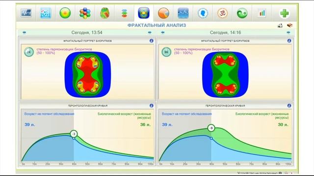 Тестирование капель для глаз MAGIC EYE на аппарате «Динамика Фарма» 16.12.2021 смотреть онлайн