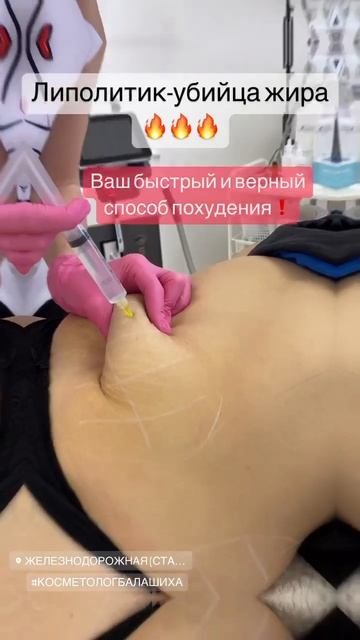 #косметологбалашиха #Лазернаяэпиляцияжелезнодорожный #косметологжелезнодорожный смотреть онлайн