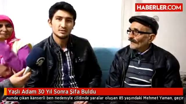Saydam Protez Göz Merkezinde Yapılan Burun Protezi. Tel: 0312 432 53 16 смотреть онлайн