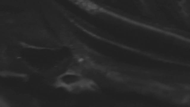 (Official Shitty Clip) Diabolik Enema - We Are F Skaters смотреть онлайн