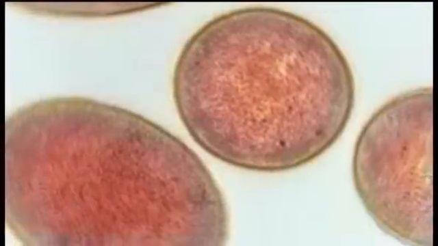 Doo Doo Transplant saves womans life смотреть онлайн