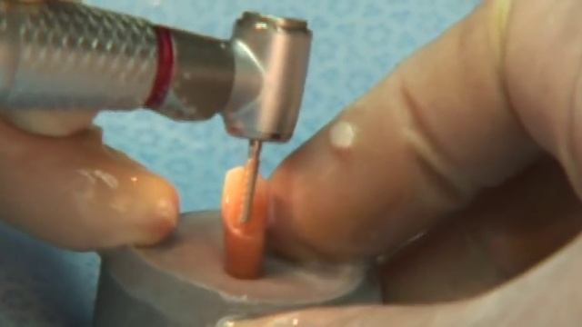 SS White Piranha 2 X Diamond All Ceramic Crown Preparation смотреть онлайн