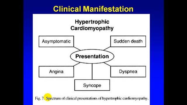 محاضرة علمية(المرحلة الرابعة / الباطنية/Cardiomyopathy )الجزء2 смотреть онлайн