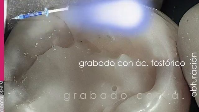 Reparación de composites смотреть онлайн