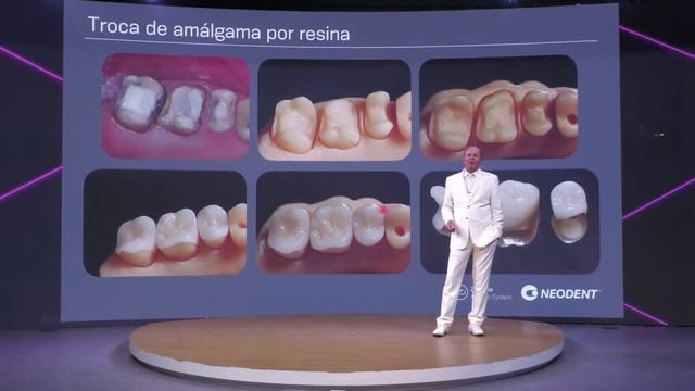 Neodent LIVE - Ceramic Implant System смотреть онлайн