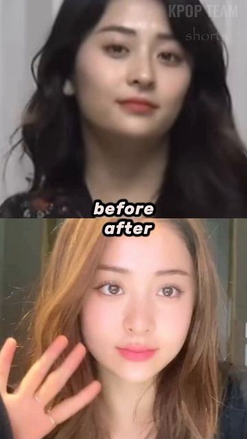 Did LE SSERAFIM Yunjin Undergo Plastic Surgery? BEFORE / AFTER #shorts #yunjin #lesserafim смотреть онлайн