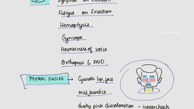 Mitral Valve Stenosis - Pathophysiology, clinical features and Management #mbbs смотреть онлайн