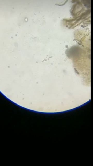 bacterial infection in animal's saliva | dog bite | #rabies #dogs #infection смотреть онлайн