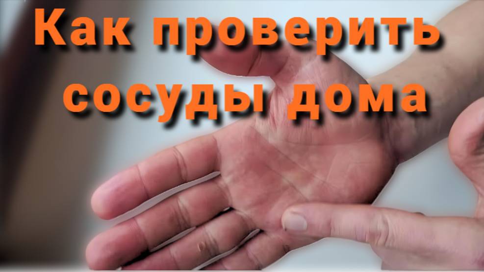 Как проверить сосуды в домашних условиях смотреть онлайн