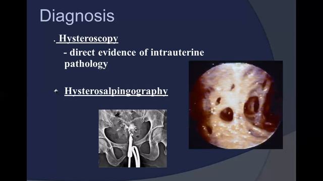 المرحلة الخامسة نسائيةLec 2 part 1 benign gyne lesion смотреть онлайн