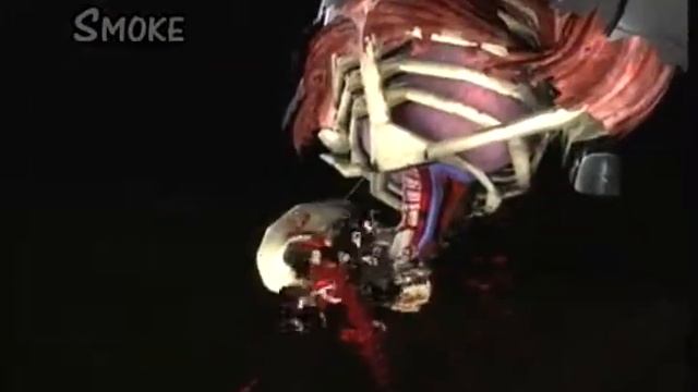 Mortal Kombat 92011) All Characters X rays смотреть онлайн