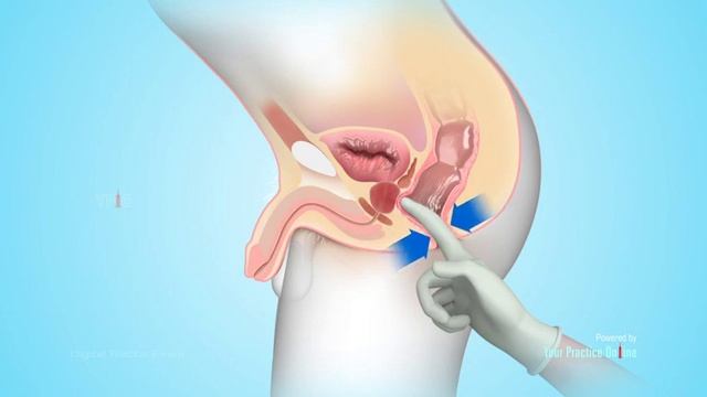 Digital Rectal Exam смотреть онлайн