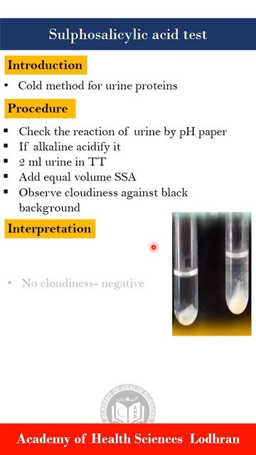 Sulphosalicylic acid test (SSA): Protein test by Imran Yaseen смотреть онлайн