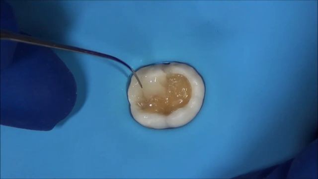 SDSC Essentia posterior смотреть онлайн