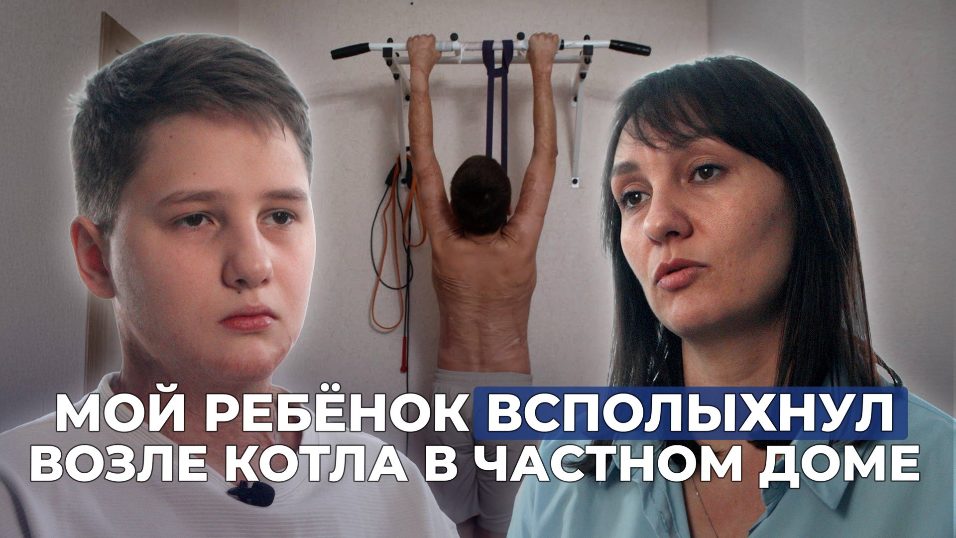 ОЖОГИ 80 % ПОВЕРХНОСТИ ТЕЛА | История Егора Васильева смотреть онлайн