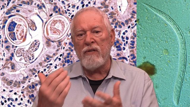Parasitic Diseases Lectures #26: Strongyloidiasis смотреть онлайн