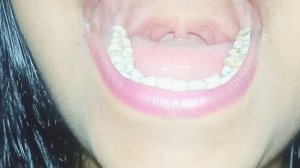 inside open mouth👄 tongue👅 challenge video zoom camera most requested video#open mouth#funny#viral