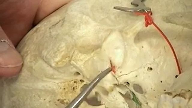 Dr. Jonathan Leo explains Skull Fossas, pt. 2 смотреть онлайн