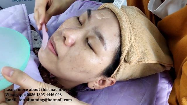 Hydra Facial Hydro Dermabrasion Aqua Peel Oxygen CO2 Therapy Skincare Machine Tutorial
