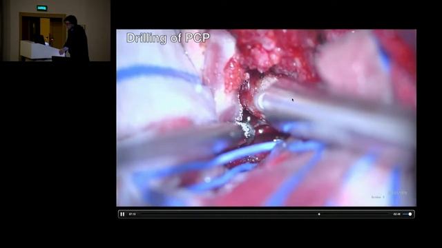 VI Московская международная нейрохирургическая конференция смотреть онлайн