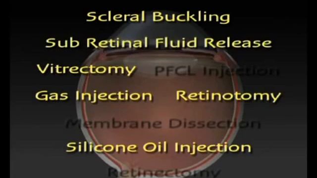 RETINAL DETACHMENT смотреть онлайн