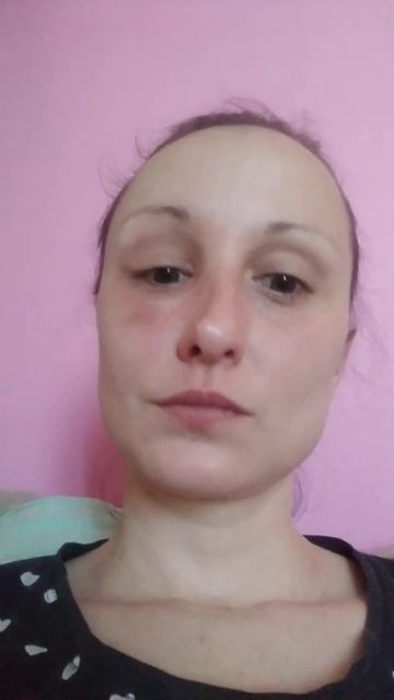 укусила мошка смотреть онлайн