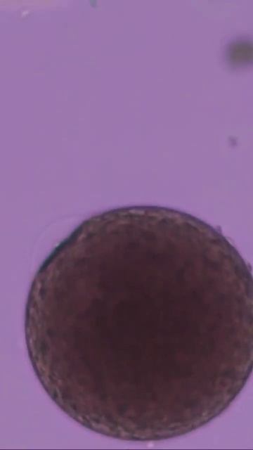 Sea urchin fertilization 2 #shorts смотреть онлайн
