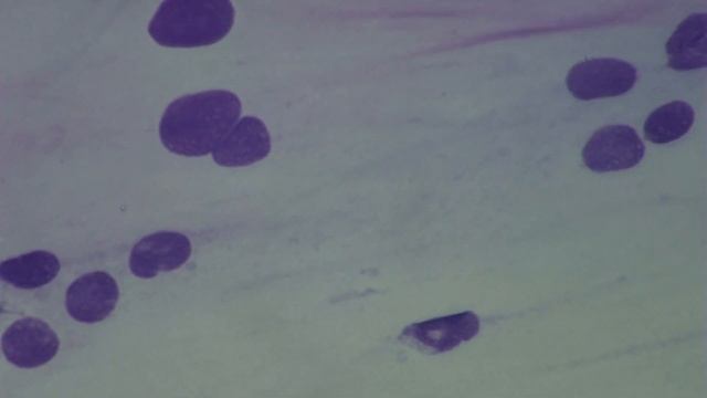 Gynaecology. Cervix. Analysis cytologica. Nuclei nudis. смотреть онлайн