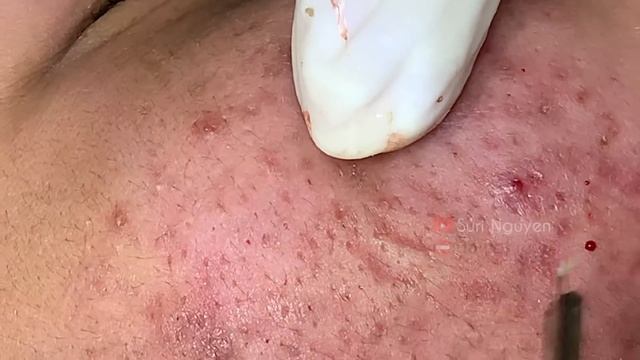 Satisfying And Relaxation With SURI NGUYEN Beauty Spa Video #459