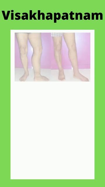 Filariasis Surgery cost in Visakhapatnam,Filariasis Treatment in Visakhapatnam смотреть онлайн