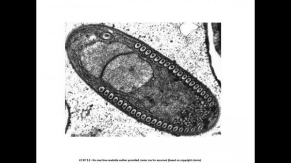 Microsporidia
