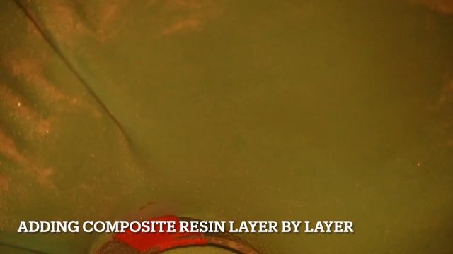 25 re-treatment from crown removal to endodontic retreatment смотреть онлайн