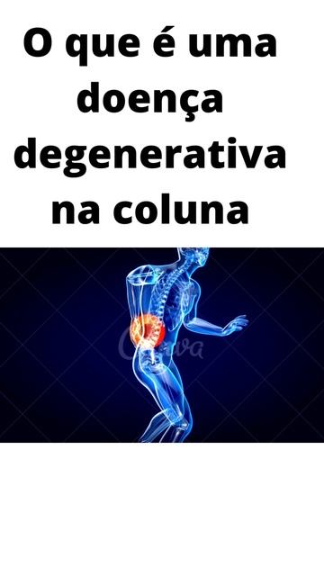 O que é uma doença degenerativa na coluna?#shorts #shortsyoutube #shortsvideo #artrite #artritis смотреть онлайн