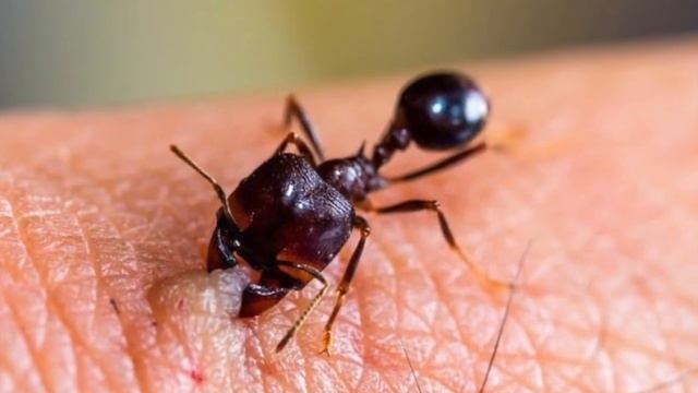 Top 5 Most Painful Insect Bites/Stings in the World смотреть онлайн