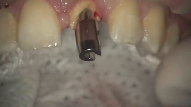 Benex Control   копия