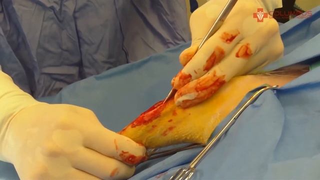 Penny the Papillon Has Bilateral Luxating Patella Surgeries смотреть онлайн