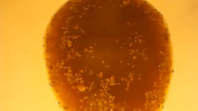 ♥ ♥ ♥ CIRRHOSIS DIETS ♥ ♥ ♥ Coffee Enema ♥ Proves ♥ Liver & Gallbadder Flush ♥ Stones ♥ 100% Real смотреть онлайн