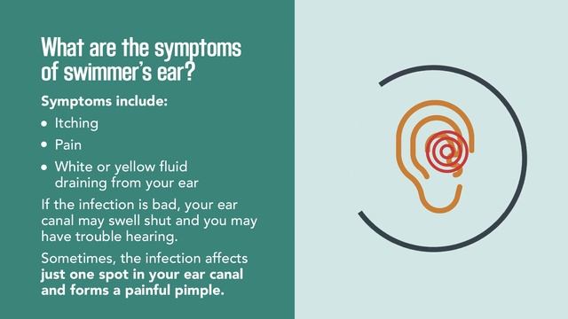 Swimmer's Ear: Quick Facts | Ear Infections | Merck Manual Consumer Version смотреть онлайн
