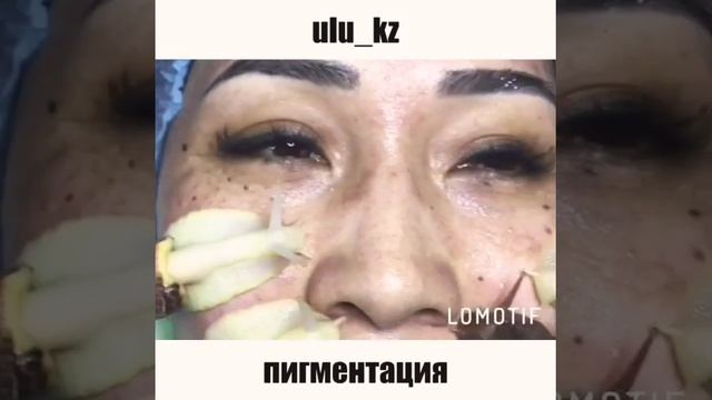 Улиткотерапия @ ulu_kz смотреть онлайн