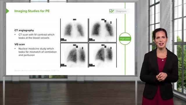 2.07 Pulmonary Embolism (PE)- Imaging Studies смотреть онлайн