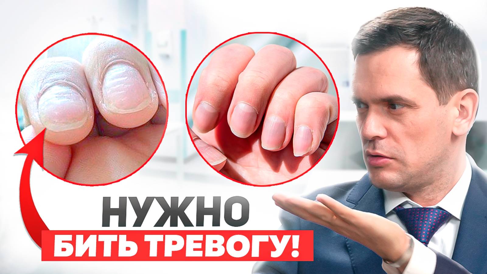 Ногти КРИЧАТ о ваших проблемах со здоровьем! Обрати внимание на эти 3 признака смотреть онлайн
