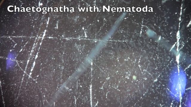 Chaetognatha with Nematoda смотреть онлайн