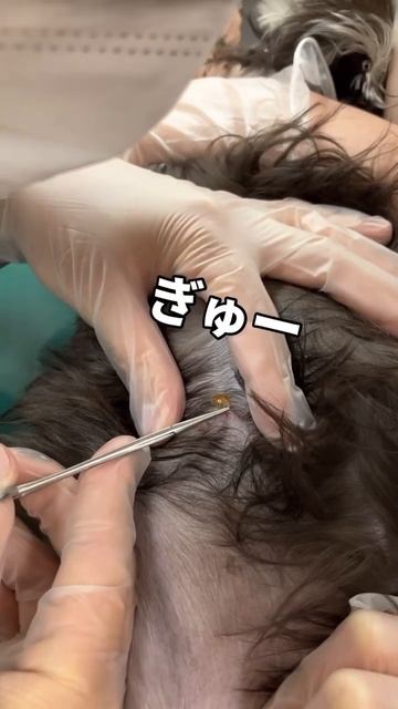 落ち込んでいます、、#いぬ #dog #ダニ #ダニ対策 смотреть онлайн