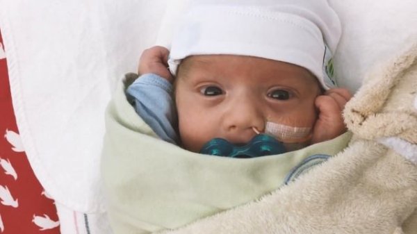 Baby born at 26 weeks
