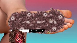ASMR Remove Maggots  Worm Infected Foot Deep Cleaning |ASMR Animation Treatment @ViPasmr0.1
