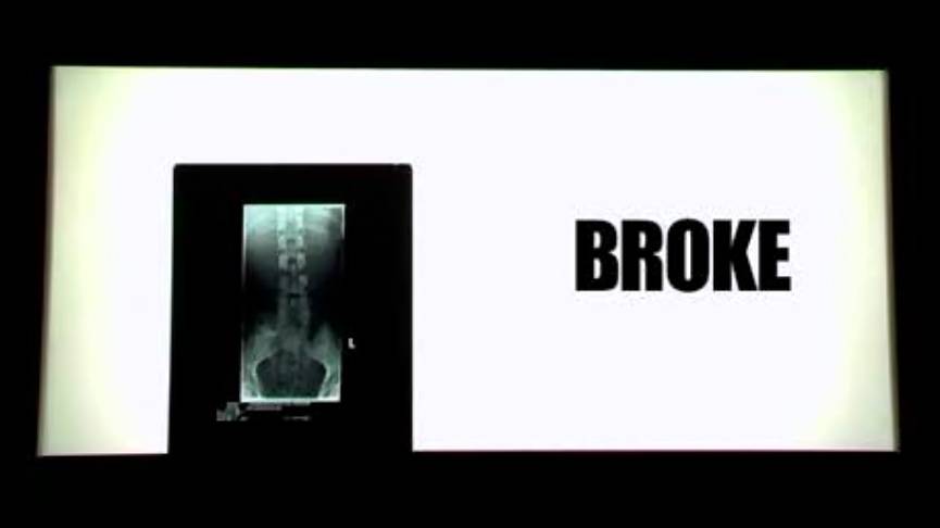 [aggressive Inline] BROKE