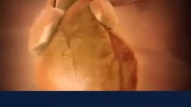 Программа бросить курить смотреть онлайн