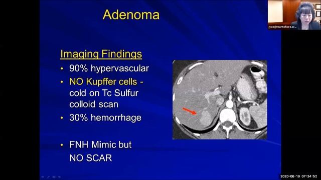 Imaging Workup Of Focal Liver Masses