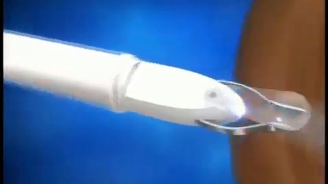 Alisveriscagi.com'dan Led Işıklı ve Büyüteçli Cımbız смотреть онлайн