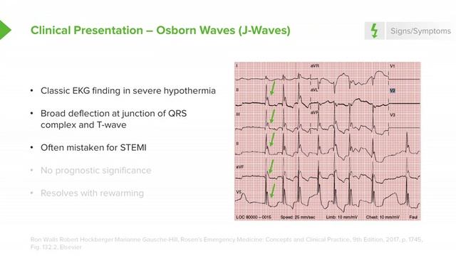 1.02 Accidental Hypothermia- Symptoms смотреть онлайн